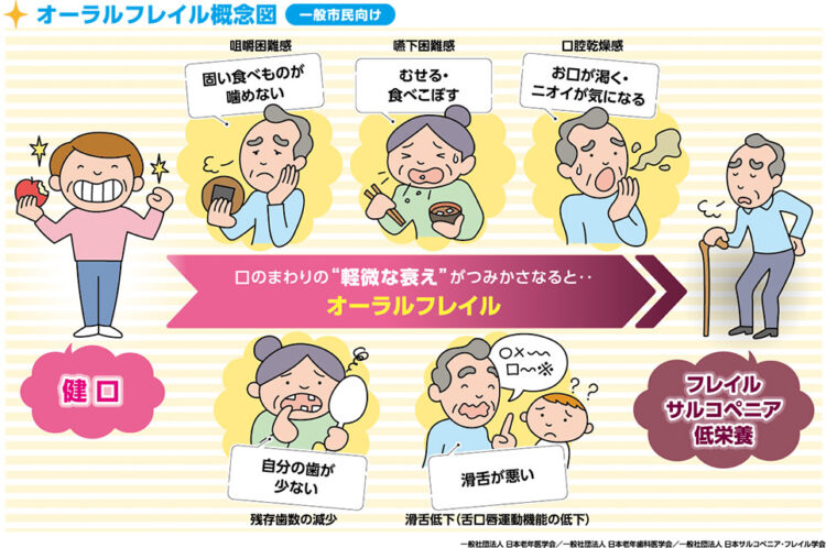 オーラルフレイルの図